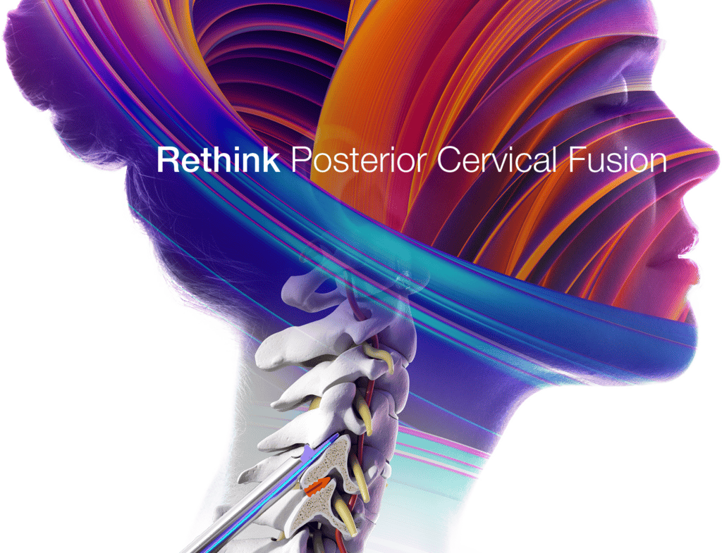 CORUS Spinal System for Posterior Cervical Fusion | Providence