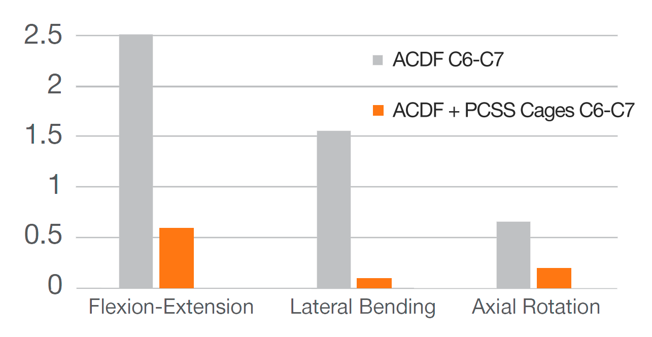 Chart showing the biomechanical stability of plated ACDF compared to ACDF plus CORUS PCSS (Posterior Cervical Stabilization System)
